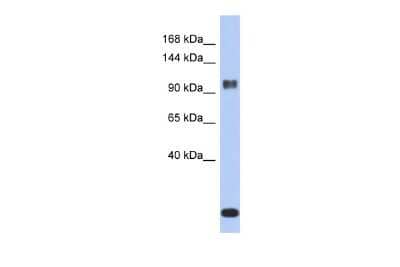 Western Blot: Ataxin 7 Antibody [NBP2-83942] - WB Suggested Anti-ATXN7 Antibody Titration: 0.2-1 ug/ml. ELISA Titer: 1:62500. Positive Control: ACHN cell lysate