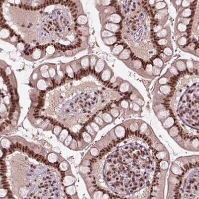 Immunocytochemistry/ Immunofluorescence Ataxin 7-Like 3 Antibody - BSA Free