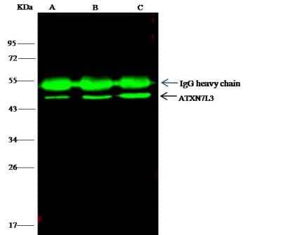 Immunoprecipitation: Ataxin 7-Like 3 Antibody [NBP2-99131] - Lane A:0.5 mg Raji Whole Cell LysateLane B:0.5 mg K562 Whole Cell LysateLane C:0.5 mg THP-1 Whole Cell Lysate4 uL anti-ATXN7L3 rabbit polyclonal antibody and 15 ul of 50 % Protein G agarose.Primary antibody:Anti-ATXN7L3 rabbit polyclonal antibody,at 1:100 dilution Secondary antibody:Dylight 800-labeled antibody to rabbit IgG (H+L), at 1:5000 dilution Developed using the odssey technique.Performed under reducing conditions.Predicted band size: 38 kDaObserved band size: 45 kDa