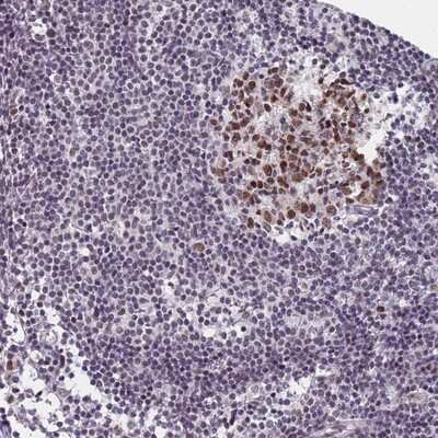 Immunohistochemistry-Paraffin Atherin Antibody