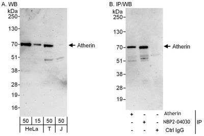 Immunoprecipitation Atherin Antibody