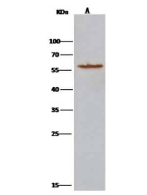 Immunoprecipitation: Atlastin-3 Antibody [NBP2-97067] - Atlastin-3 was immunoprecipitated using: Lane A: 0.5 mg Jurkat Whole Cell Lysate 2 ul anti-Atlastin-3 rabbit polyclonal antibody and 15 ul of 50 % Protein G agarose. Primary antibody: Anti-Atlastin-3 rabbit polyclonal antibody, at 1:100 dilution. Secondary antibody: Clean-Bloto IP Detection Reagent (HRP) at 1:1000 dilution. Developed using the DAB staining technique. Performed under reducing conditions. Predicted band size: 61 kDa. Observed band size: 61 kDa