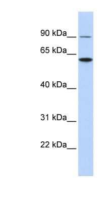 Western Blot: Atlastin-3 Antibody [NBP1-59034] - HCT15 cell lysate, concentration 0.2-1 ug/ml.