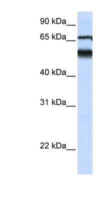 Western Blot: Atlastin-3 Antibody [NBP1-59035] - Human Lung lysate, concentration 0.2-1 ug/ml.