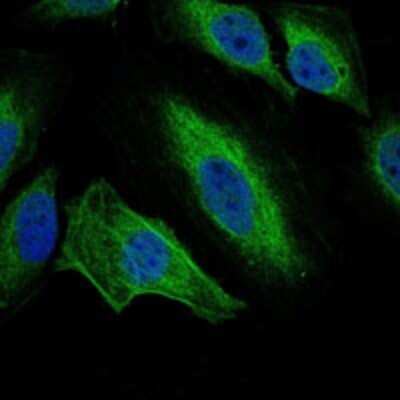 Immunocytochemistry/Immunofluorescence: Aurora A Antibody (1F8) - Azide and BSA Free [NBP2-80587] - Analysis of Hela cells using Aurora A mouse mAb (green). DRAQ5 fluorescent DNA dye (blue). Image from the standard format of this antibody.