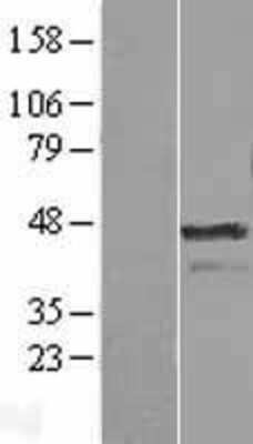 Western Blot Aurora A Overexpression Lysate