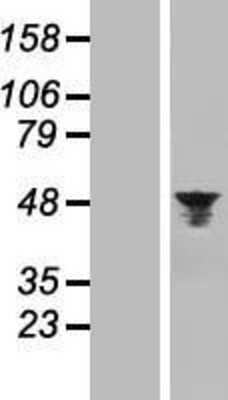 Western Blot: Aurora A Overexpression Lysate (Adult Normal) [NBL1-07857] Left-Empty vector transfected control cell lysate (HEK293 cell lysate); Right -Over-expression Lysate for Aurora A.