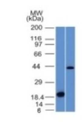 Western Blot: Aurora B Antibody (AURKB/1521) [NBP2-54478] - Analysis (A) Recombinant Protein (B) Human Liver Lysate Using Aurora B Monoclonal Antibody (AURKB/1521).