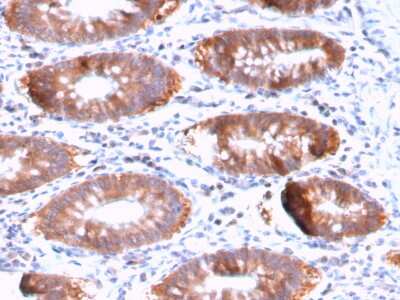 Immunohistochemistry-Paraffin: Aurora B Antibody (AURKB/3121R) - Azide and BSA Free [NBP3-08280] - Formalin-fixed, paraffin-embedded human Colon stained with Aurora B Rabbit Recombinant Monoclonal Antibody (AURKB/3121R).