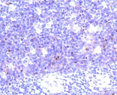 Immunohistochemistry-Paraffin: Aurora B Antibody (SC55-08) [NBP2-67568] - Analysis of paraffin-embedded human tonsil tissue using anti-Aurora B antibody. Counter stained with hematoxylin.