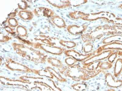 Immunohistochemistry-Paraffin: Aurora B Antibody (rAURKB/1592) - Azide and BSA Free [NBP3-08877] - Formalin-fixed, paraffin-embedded human kidney stained with Aurora B Recombinant Mouse Monoclonal Antibody (rAURKB/1592).