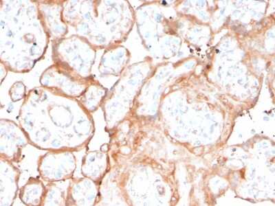 Immunohistochemistry-Paraffin: Aurora B Antibody (rAURKB/1592) - Azide and BSA Free [NBP3-08877] - Formalin-fixed, paraffin-embedded human placenta stained with Aurora B Recombinant Mouse Monoclonal Antibody (rAURKB/1592).