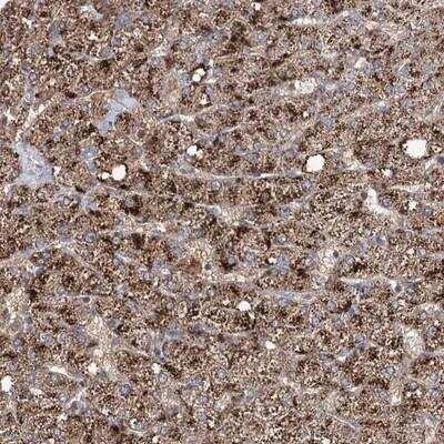 Immunohistochemistry: Aurora C Antibody [NBP1-90819] - Staining of human liver shows strong granular cytoplasmic positivity in hepatocytes.