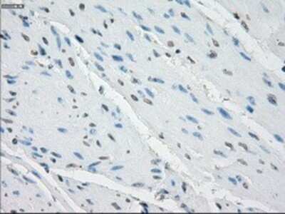 Immunohistochemistry: Aurora C Antibody (OTI2B7) - Azide and BSA Free [NBP2-71303] - Staining of paraffin-embedded bladder tissue using anti-Aurora C mouse monoclonal antibody.
