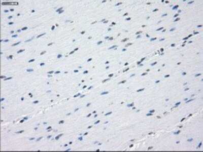 Immunohistochemistry: Aurora C Antibody (OTI2B7) - Azide and BSA Free [NBP2-71303] - Staining of paraffin-embedded colon tissue using anti-Aurora C mouse monoclonal antibody.