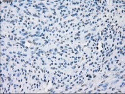 Immunohistochemistry: Aurora C Antibody (OTI2B7) - Azide and BSA Free [NBP2-71303] - Staining of paraffin-embedded endometrium tissue using anti-Aurora C mouse monoclonal antibody.