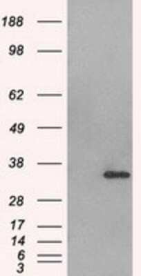 Western Blot: Aurora C Antibody (OTI2B7) - Azide and BSA Free [NBP2-71303] - HEK293T cells were transfected with the pCMV6-ENTRY control (Left lane) or pCMV6-ENTRY Aurora C (Right lane) cDNA for 48 hrs and lysed. Equivalent amounts of cell lysates (5 ug per lane) were separated by SDS-PAGE and immunoblotted with anti-Aurora C.