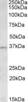 Western Blot: Aurora C Antibody [NBP1-52004] - Analysis of Aurora C in Human Testis lysate (35ug protein in RIPA buffer) using NBP1-52004 at 1.5 ug/ml. Primary incubation was 1 hour. Detected by chemiluminescence.