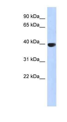 Western Blot: Aurora C Antibody [NBP1-54994] - Human Pancrease lysate, concentration 0.2-1 ug/ml.