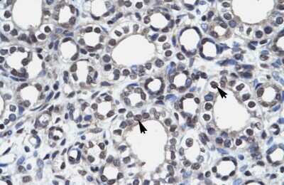 Immunohistochemistry-Paraffin: Autoimmune Regulator/AIRE Antibody [NBP3-10950] - Immunohistochemical analysis of paraffin-embedded human kidney tissue.