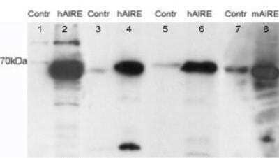 Western Blot: Autoimmune Regulator/AIRE Antibody [NB100-40799] - Analysis of HEK293 cell lysates. Untransfected (Lane 3) and transfected with Human AIRE (lane 4). Data kindly provided by Prof. Part Peterson, University of Tartu, Estonia.