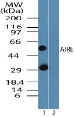 Western Blot: Autoimmune Regulator/AIRE Antibody [NBP2-24624] - Analysis of AIRE in human spleen lysate in the 1) absence and 2) presence of immunizing peptide using this antibody at 5 ug/ml.