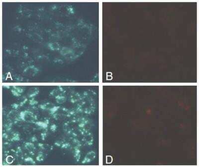Functional: Autophagy/Cytotoxicity Dual Staining Other Kit [KA1299] - Tamoxifen increases autophagy but not cell death in HepG2 cells as measured by fluorescence microscopy.  Panel A : MDC staining of HepG2 cells treated with vehicle. There is a basal level of autophagy, indicated by faint silver dot staining of autophagic vacuoles.  Panel B : Propidium iodide staining of HepG2 cells treated with vehicle. There are few dead cells with only background staining of propidium iodide.  Panel C : MDC staining of HepG2 cells treated with 10 uM Tamoxifen.  Panel D : Propidium iodide staining of HepG2 cells treated with 10 uM Tamoxifen, showing a similar staining pattern to that of cells treated with vehicle