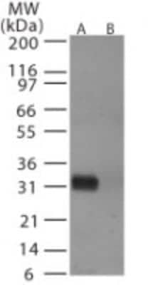 Western Blot: Avian Influenza A H6N1 Hemagglutinin Antibody [NB100-56607] - analysis of avian flu HA in (A) recombinant fusion protein containing amino acids 72-88 and (B) fusion partner without these amino acids, using this antibody. 5 ug/ml.