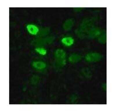 Immunocytochemistry/Immunofluorescence: Avian Influenza A Hemagglutinin Antibody Pack [NBP2-25066] - Staining of influenza-infected MDCK cells with NB100-56572 at 1:10 dilution. Image Courtesy of Catherine Thompson, The University of Reading