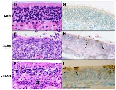 Immunohistochemistry: Avian Influenza A Hemagglutinin Antibody Pack [NBP2-25066] - VN1203 induced significant pathology despite similar nasal turbinate titers in ferrets infected with either virus. Viral titers of homogenized nasal turbinates were graphed as mean +/- SEM for VN1203 or HK483 infected ferrets. D-I. Representative samples of nasal turbinate tissue of ferrets instilled with allantoic fluid (D,G), HK483 (E,H), or VN1203 (F,I). D-F were stained with H&E, G-I were stained with anti-avian influenza NP (NB100-56572) and counterstained with Luxol fast blue. F. # indicates inflammatory cells infiltrating the underlying stroma. H,I. Arrows point to H5N1 infected cells. Scale bars: D-F, 300 um; G-I, 100 um. Image collected and cropped by CiteAb from the following publication (//dx.plos.org/10.1371/journal.pone.0046605) licensed under a CC-BY license. 