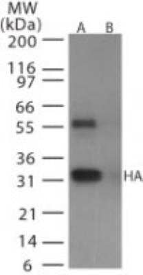 Western Blot: Avian Influenza A Hemagglutinin Antibody Pack [NBP2-25066] - Analysis of avian flu HA in (A) recombinant fusion protein containing amino acids 128-143 and (B) fusion partner without these amino acids, using NB100-56608 at 0.5 ug/ml.