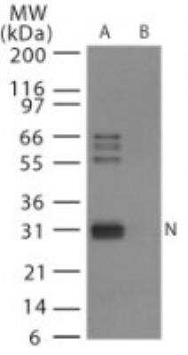 Western Blot: Avian Influenza A Hemagglutinin Antibody Pack [NBP2-25066] - Analysis of avian flu nucleoprotein in (A) recombinant fusion protein containing amino acids 58-77 and (B) fusion partner without these amino acids, using NB100-56611 at 0.5 ug/ml.