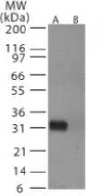 Western Blot: Avian Influenza A Hemagglutinin Antibody Pack [NBP2-25066] - Analysis of avian flu HA in (A) recombinant fusion protein containing amino acids 72-88 and (B) fusion partner without these amino acids, using NB100-56607 at 0. 5 ug/ml.