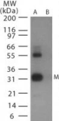 Western Blot: Avian Influenza A Hemagglutinin Antibody Pack [NBP2-25066] - Analysis of avian flu matrix protein 1 in (A) recombinant fusion protein containing amino acids 9-28 and (B) fusion partner without these amino acids, using NB100-1933 at 0.5 ug/ml.