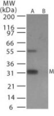 Western Blot: Avian Influenza A Hemagglutinin Antibody Pack [NBP2-25066] - Analysis of avian flu matrix protein 1 in (A) recombinant fusion protein containing amino acids 212-225 and (B) fusion partner without these amino acids, using NB100-56610 at 0.5 ug/ml.