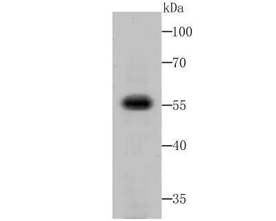 Western Blot: Avian avulavirus 1 Fusion Glycoprotein F0 Antibody [NBP2-75927] - analysis of Fusion glycoprotein F0 on Fusion glycoprotein F0 transfected HEK293 cell lysates using anti- Fusion glycoprotein F0 antibody at 1/500 dilution.