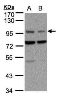 Western Blot: Axin-1 Antibody [NBP1-31013] -  Sample(30 ug of whole cell lysate)A:A431 B:H12997. 5% SDS PAGE, antibody diluted at 1:1500.