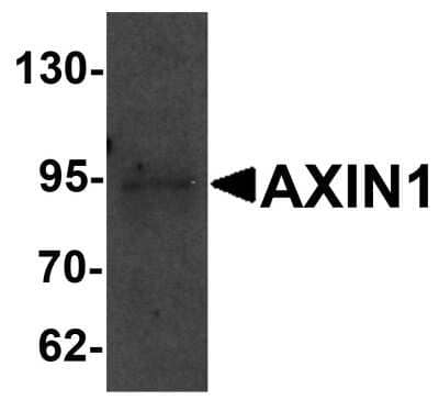 Western Blot: Axin-1 Antibody [NBP1-76483] - SK-N-SH cell lysate with AXIN1 antibody at 1 ug/mL.