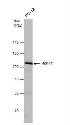 Western Blot: Axin-1 Antibody [NBP2-15529] - Whole cell extracts (30 ug) was separated by 7.5% SDS-PAGE, and the membrane was blotted with AXIN1 antibody [N1N2], N-term diluted at 1:3000.