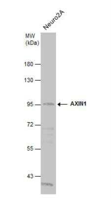 Western Blot: Axin-1 Antibody [NBP2-15529] - Whole cell extract (30 ug) was separated by 7.5% SDS-PAGE, and the membrane was blotted with AXIN1 antibody [N1N2], N-term diluted at 1:1000.