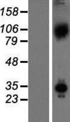 Western Blot: Axin 1 Overexpression Lysate (Adult Normal) [NBP2-04933] Left-Empty vector transfected control cell lysate (HEK293 cell lysate); Right -Over-expression Lysate for Axin 1.