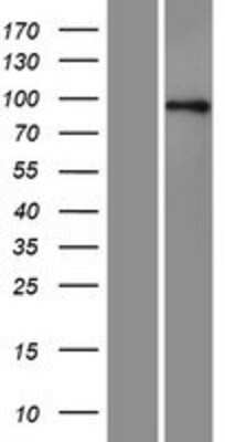 Western Blot: Axin 1 Overexpression Lysate (Adult Normal) [NBP2-10887] Left-Empty vector transfected control cell lysate (HEK293 cell lysate); Right -Over-expression Lysate for Axin 1.