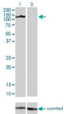 Western Blot: Axl Antibody (6C8) [H00000558-M01] - Analysis of AXL over-expressed 293 cell line, cotransfected with AXL Validated Chimera RNAi ( Cat # H00000558-R01V ) (Lane 2) or non-transfected control (Lane 1). Blot probed with AXL monoclonal antibody (M01) clone 6C8 (Cat # H00000558-M01 ). GAPDH ( 36.1 kDa ) used as specificity and loading control.