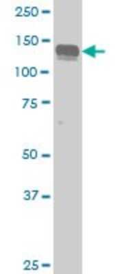 Western Blot: Axl Antibody (6G1) [H00000558-M02] - AXL monoclonal antibody (M02), clone 6G1 Analysis of AXL expression in HeLa.