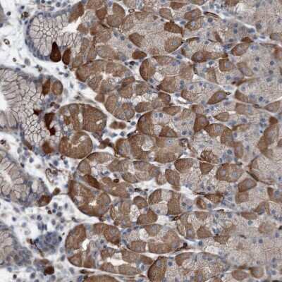 Immunohistochemistry-Paraffin: Axl Antibody [NBP2-38345] - Staining of human stomach, lower shows strong cytoplasmic positivity in glandular cells.