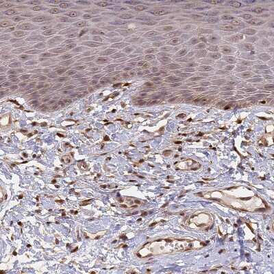 Immunohistochemistry-Paraffin: B-Myb Antibody [NBP2-33930] - Staining of human skin shows strong nuclear positivity in fibroblasts.