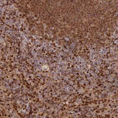 Immunohistochemistry-Paraffin: B-Myb Antibody [NBP2-33930] - Staining of human spleen shows strong nuclear positivity in a subset of lymphoid cells.
