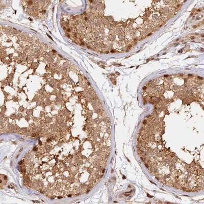 Immunohistochemistry-Paraffin: B-Myb Antibody [NBP2-33930] - Staining of human testis shows strong nuclear positivity in a subset of cells in seminiferous ducts.