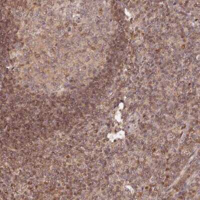 Immunohistochemistry-Paraffin: B-Myb Antibody [NBP2-33930] - Staining of human tonsil shows moderate nuclear positivity in a subset of lymphoid cells.