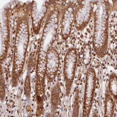 Immunohistochemistry-Paraffin: B-Myb Antibody [NBP2-33930] - Staining of human Stomach shows moderate nuclear positivity in glandular cells.